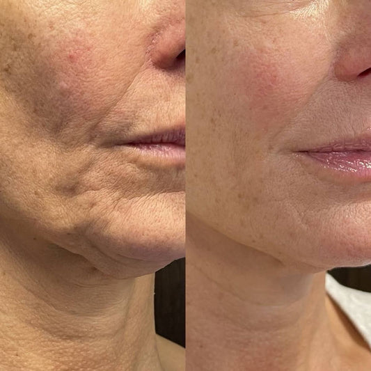 Nectaré Anti-Aging Serum Stick
