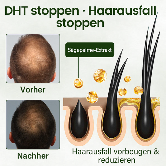 Follicure BioGrow Haarwiederherstellungs-Spray