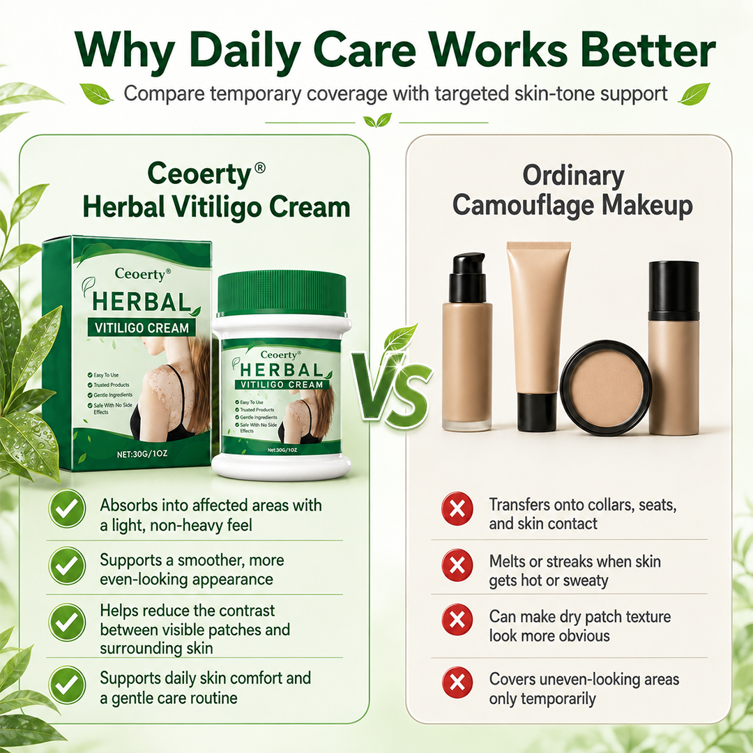 Vitarelle™ Herbal Vitiligo Creme – 7-Tage-Pflege für sichtbar gleichmäßigeren Hautton