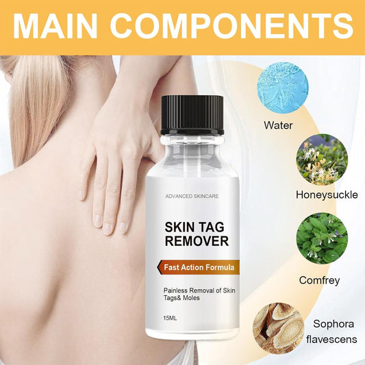Hautanhängsel Entferner - Natürliche Formel mit Jojobaöl & Vitamin E