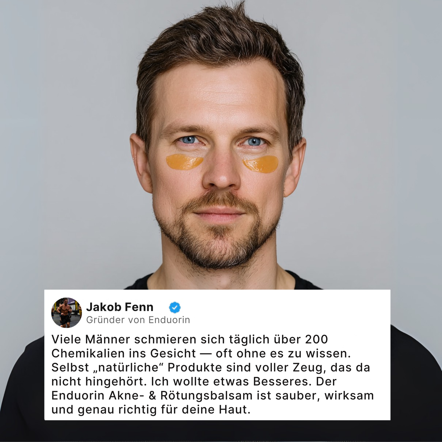 Doni™ Balsam gegen Rötungen und Akne