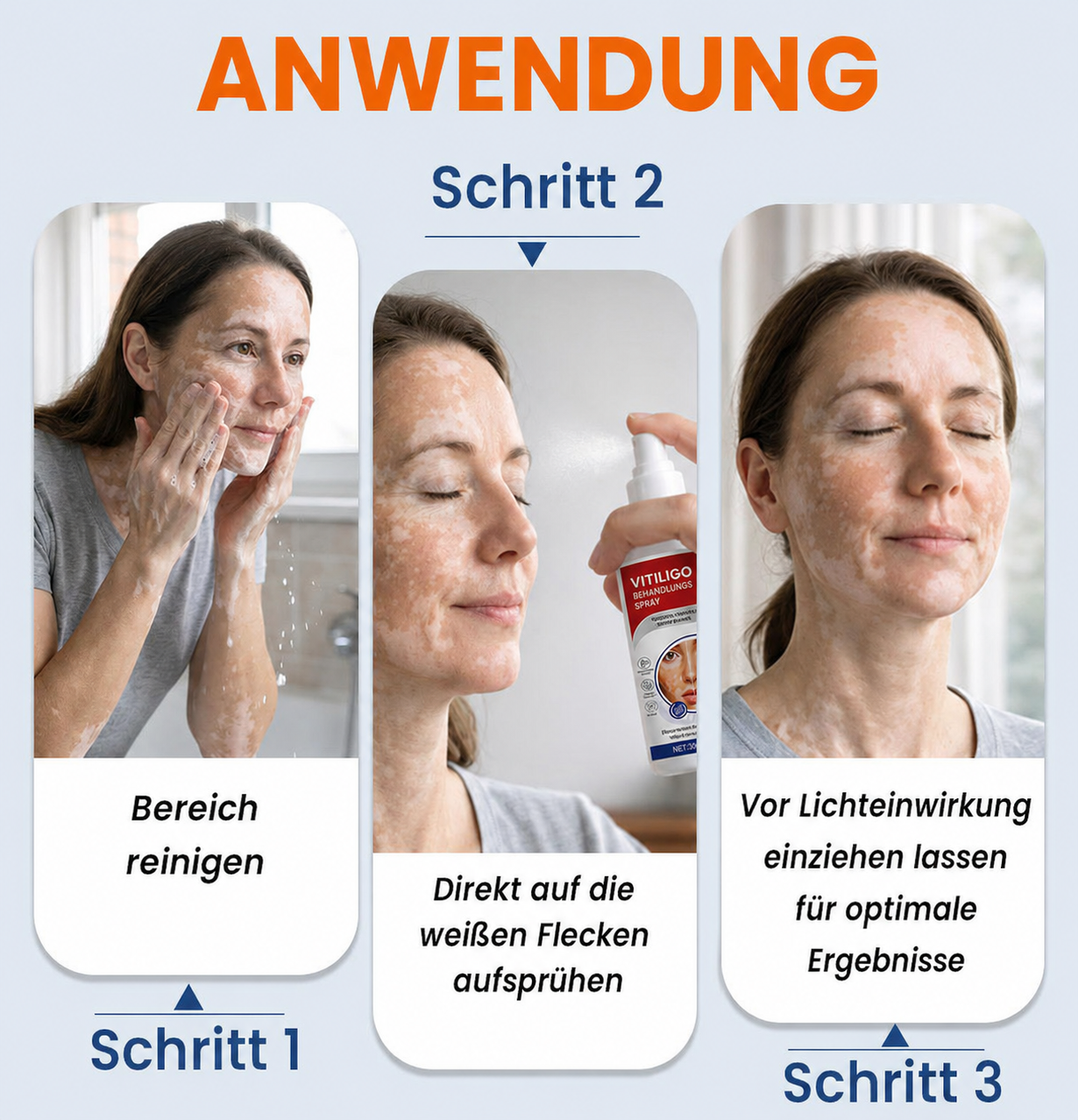 50 % Rabatt | Vitiligo-Repigment-Aktivator-Spray | Neue Verpackung!
