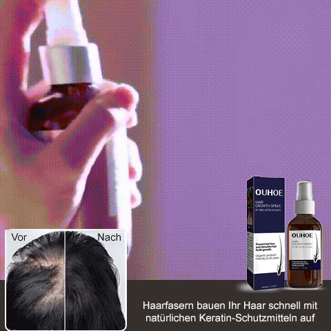 RootRevive™ Natürliches Haarpflege-Spray – Für Voller & Kräftiger Aussehendes Haar