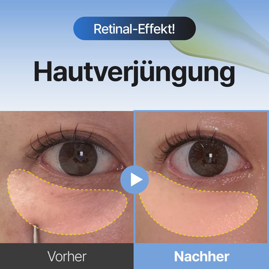 Medi™ Retinal Skin Booster Serum – Falten & Fleckenpflege