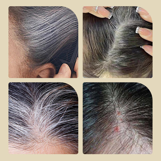 🎁1 KAUFEN, 1 GRATIS🔥Haarfärbemittel mit integriertem Kamm