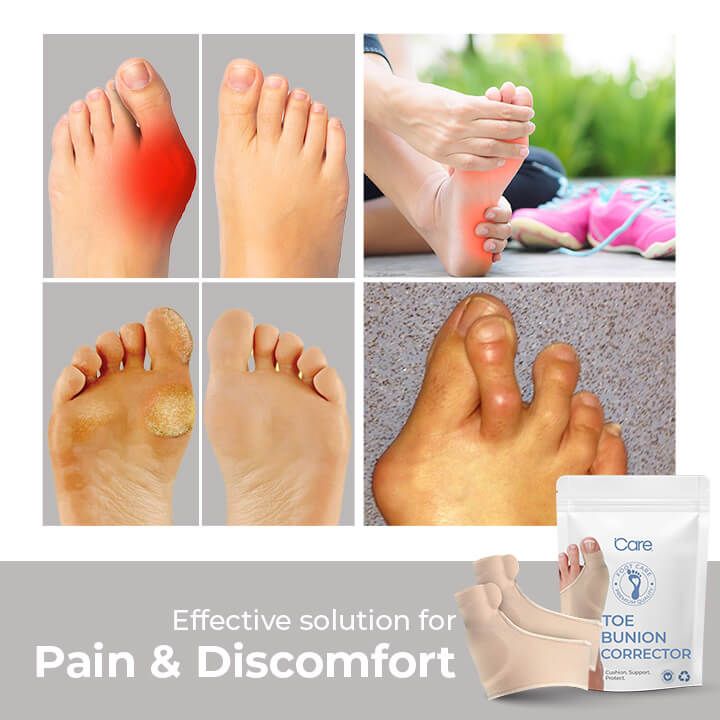 BunionPro™ | Hallux Valgus in nur 7 Tagen korrigieren