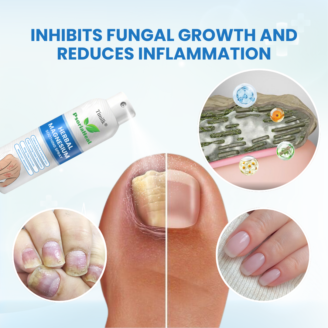 DermaMagna™ PsoriaHeal Magnesium Beruhigungsspray – Schnelle Linderung bei Juckreiz, Rötungen & Hautreizungen