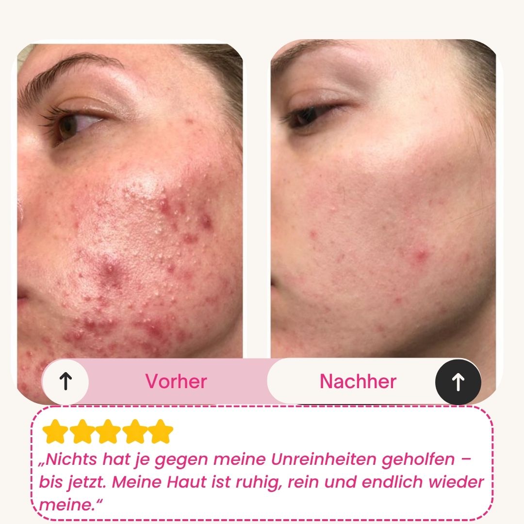 Skinly - Bio-Kollagen Maske (5 Masken)