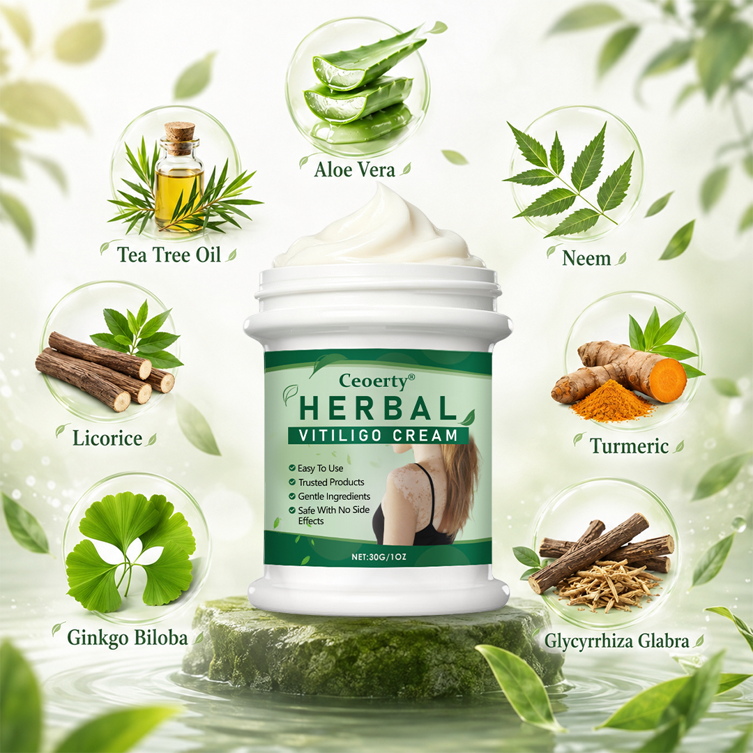 Vitarelle™ Herbal Vitiligo Creme – 7-Tage-Pflege für sichtbar gleichmäßigeren Hautton
