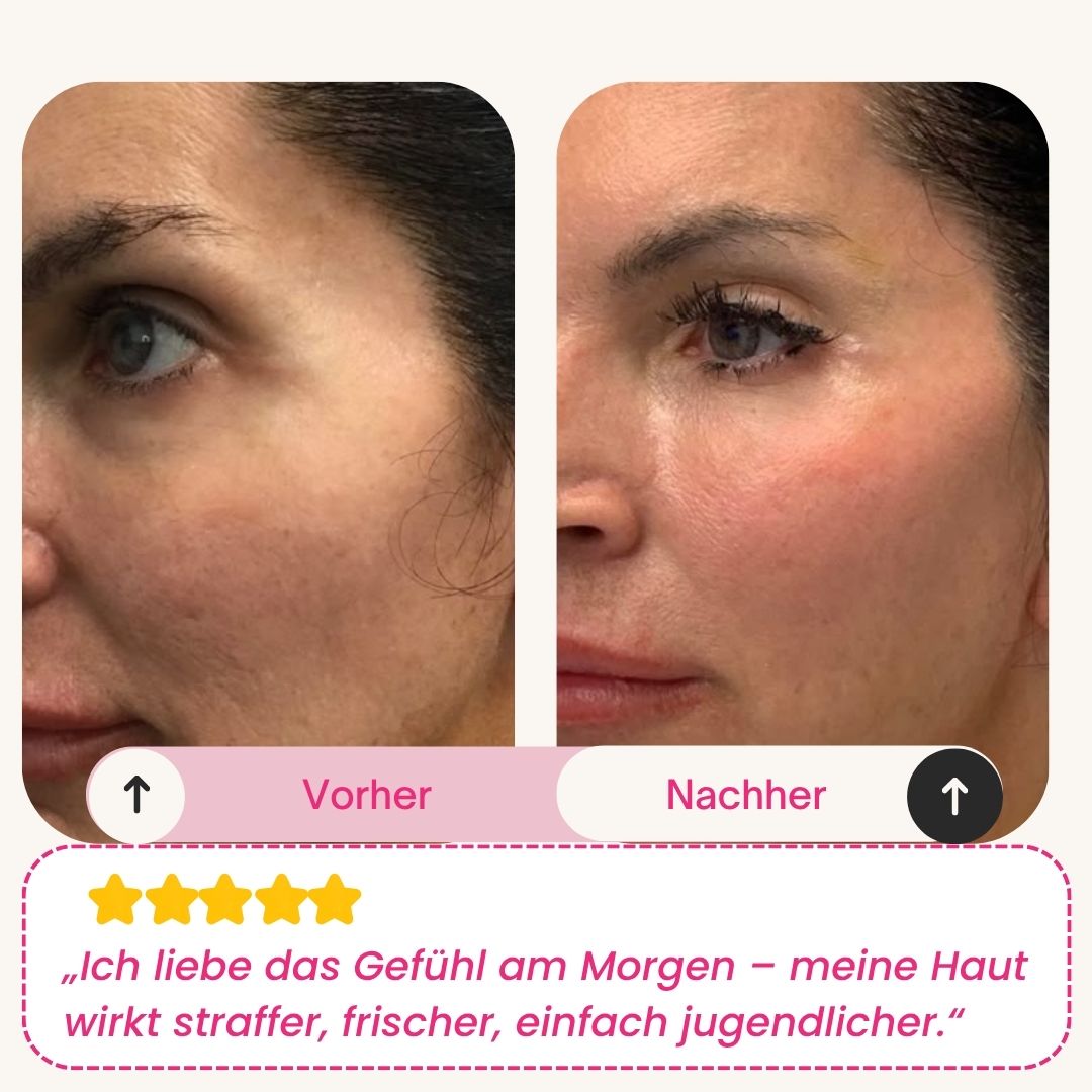 Skinly - Bio-Kollagen Maske (5 Masken)