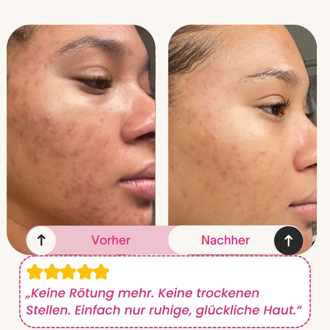 Skinly - Bio-Kollagen Maske (5 Masken)