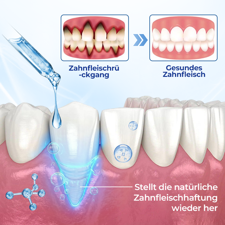 GumVita™ Zahnfleisch-Repair Lösung – Unterstützt gesundes Zahnfleisch & lindert Zahnfleischbeschwerden