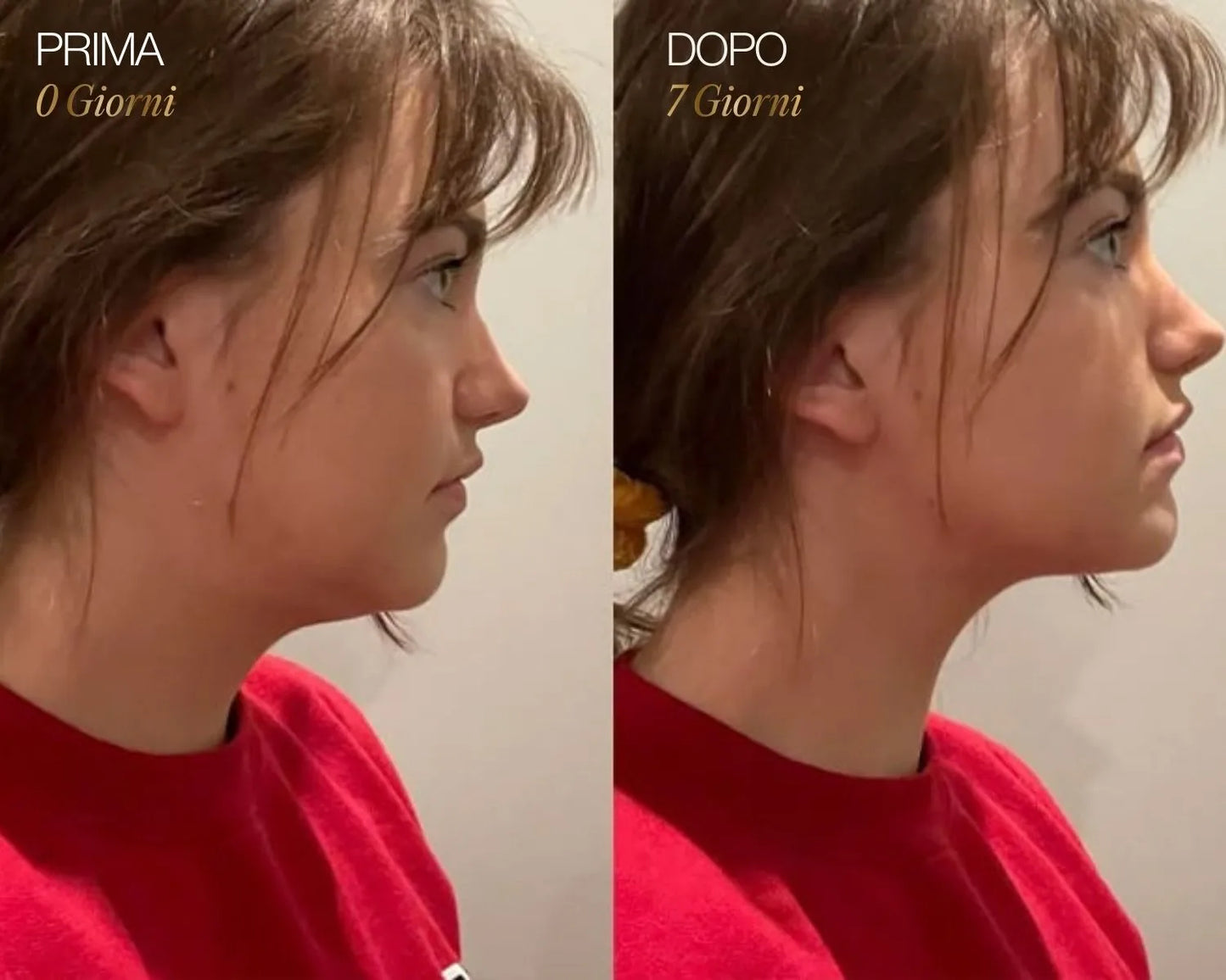 Velymra™ Lymphatic Face Brush – Gesicht entstauen, Kieferlinie definieren & Haut straffen
