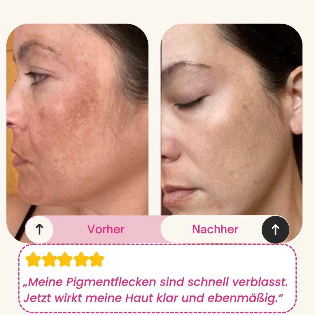 Skinly - Bio-Kollagen Maske (5 Masken)
