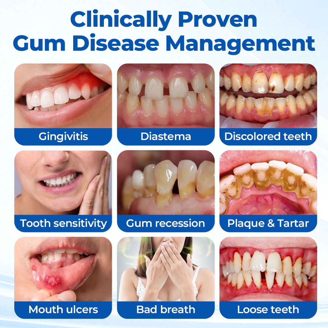 GumRevia™ GumBiome Recovery Gel – Gezielte Pflege für Zahnfleisch & Zahnfleischrückgang