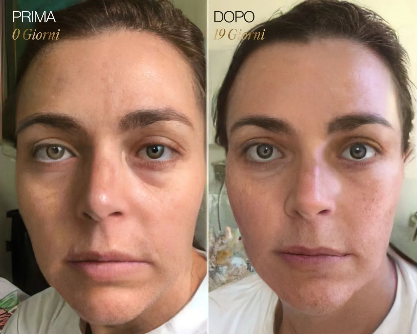 Velymra™ Lymphatic Face Brush – Gesicht entstauen, Kieferlinie definieren & Haut straffen