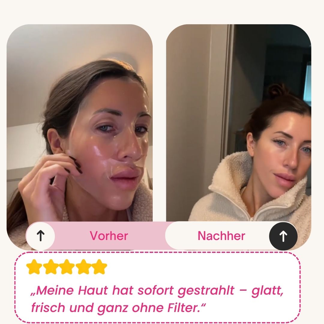 Skinly - Bio-Kollagen Maske (5 Masken)