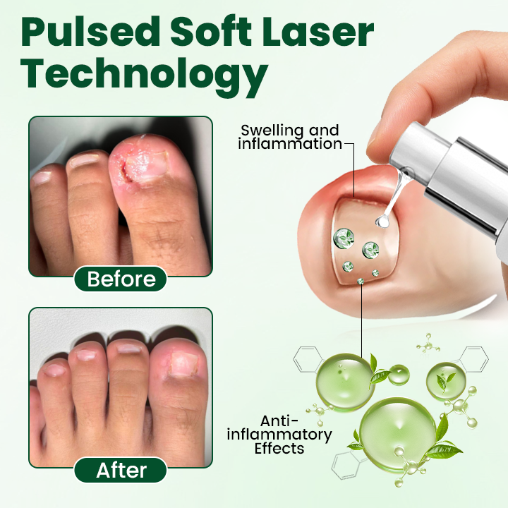 NailVanta™ Nagel-Reparatur & Pflegegel – Gegen Nagelpilz, Brüchigkeit & Verfärbungen