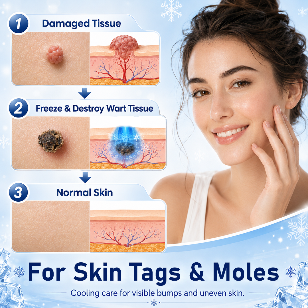 CryoLisse™ Bump-Erneuerungsspray – Erhabene Unebenheiten glätten, Rötungen beruhigen & raue Haut pflegen