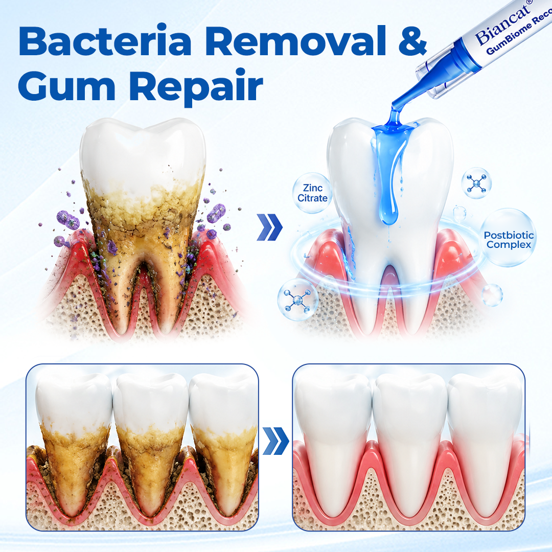 GumRevia™ GumBiome Recovery Gel – Gezielte Pflege für Zahnfleisch & Zahnfleischrückgang