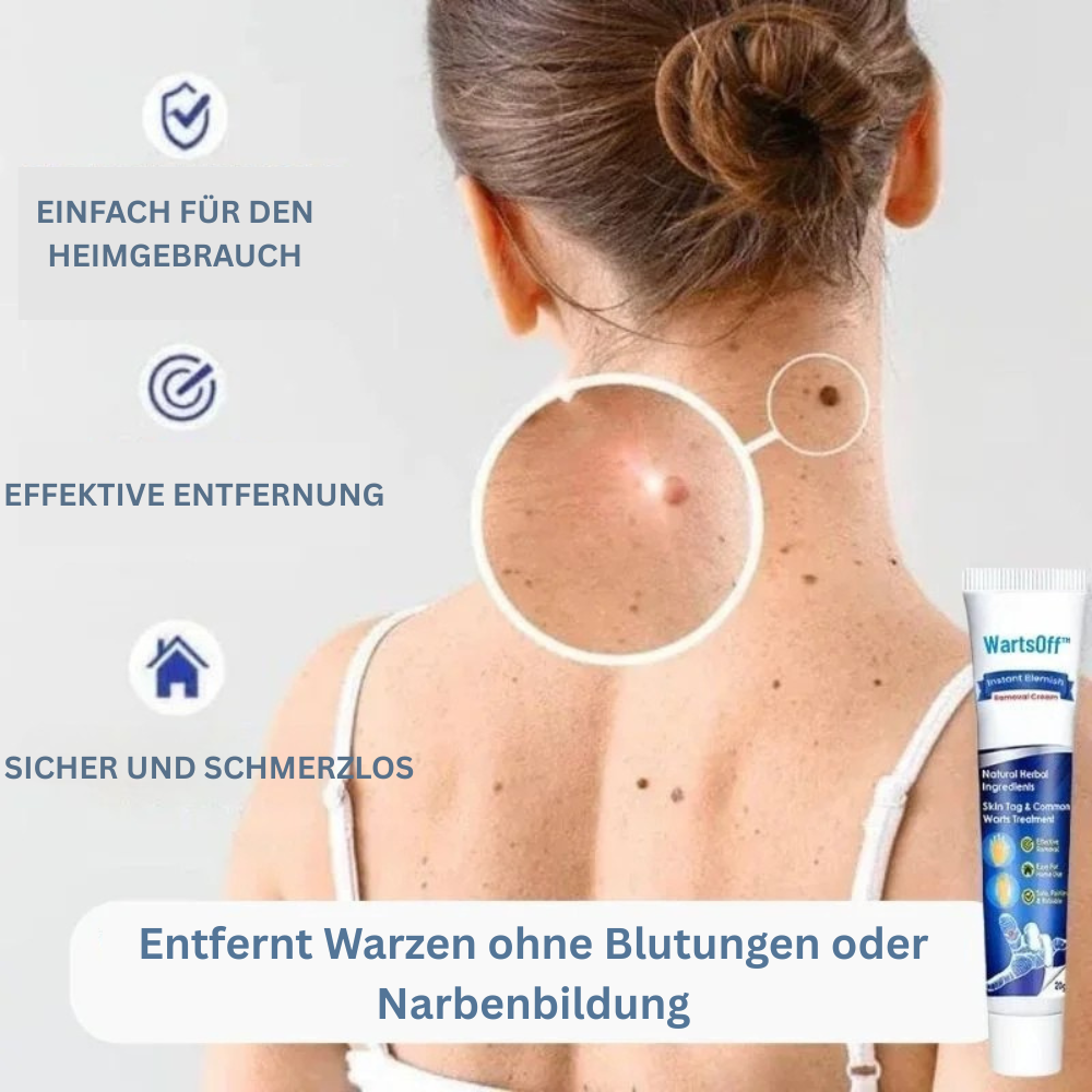 WartsOff™ | Warzen sanft & schmerzfrei entfernen!