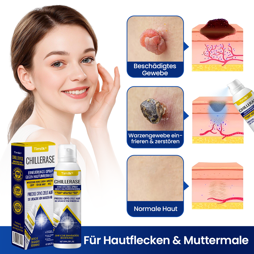 Timilk® ChillErase Erneuerungs-Spray gegen Hautunreinheiten