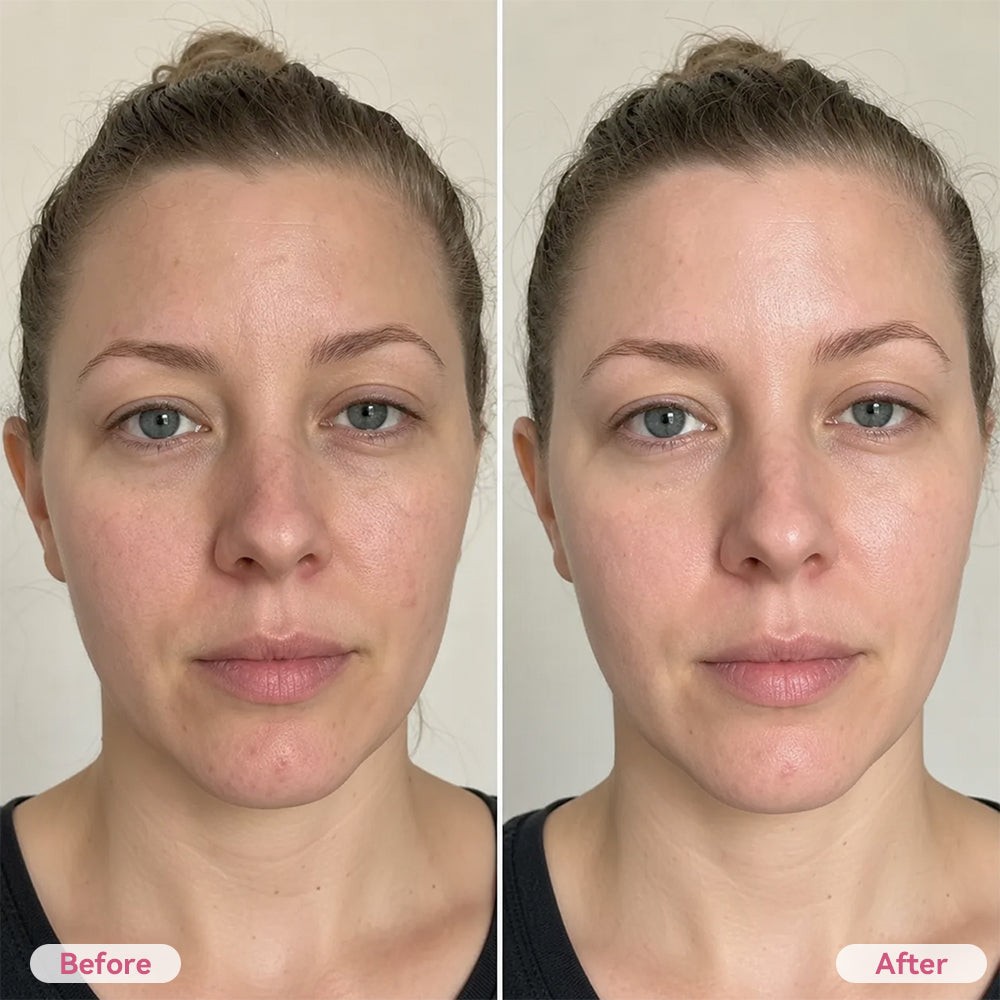 Porelia™ Porenverfeinernde Toner-Pads – Poren sichtbar verfeinern, Haut glätten & überschüssiges Öl ausgleichen