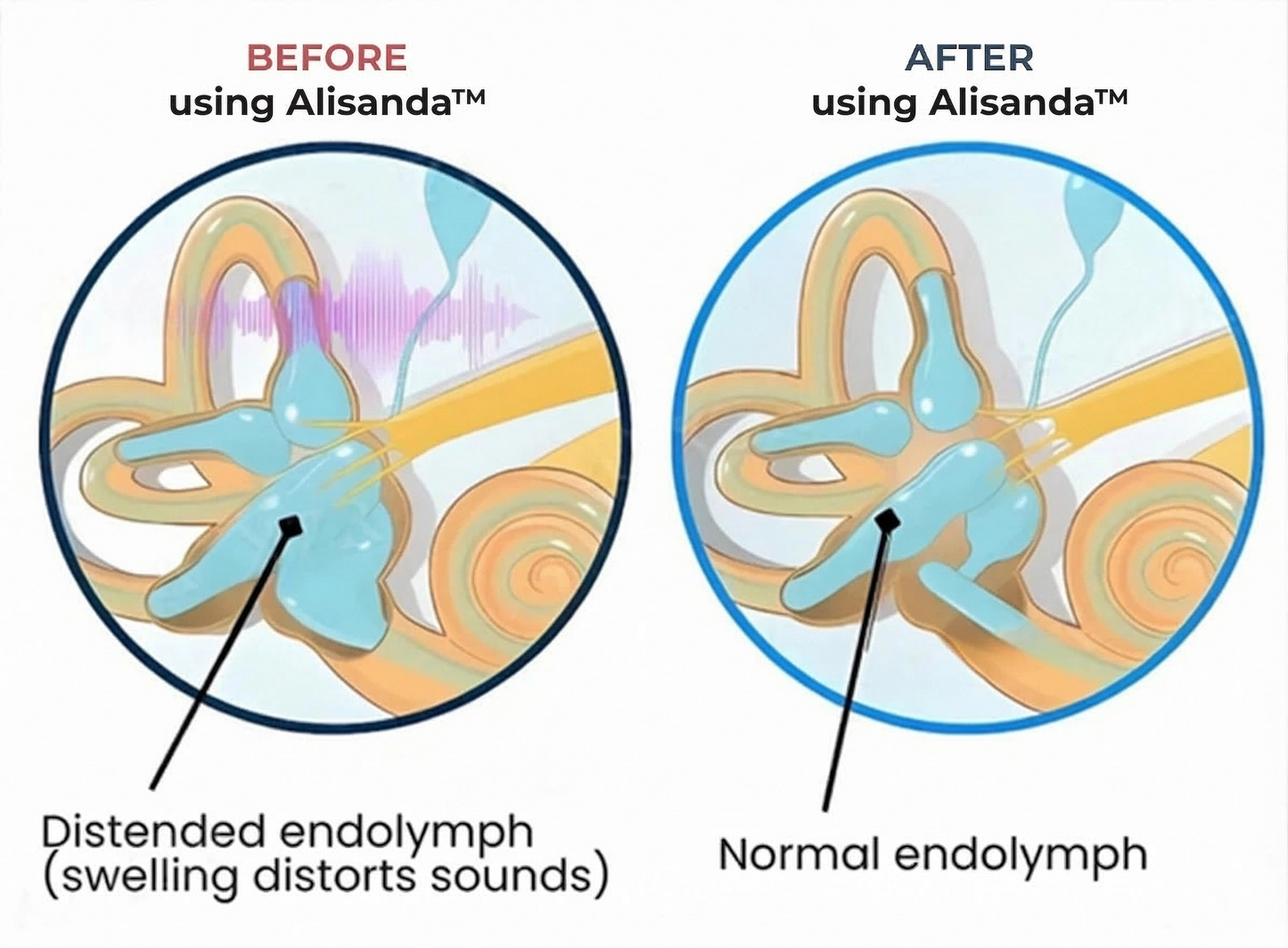 TinniVexa™ Tinnitus Relief Gerät – NeuroPulse-Technologie für schnelle, medikamentenfreie Linderung