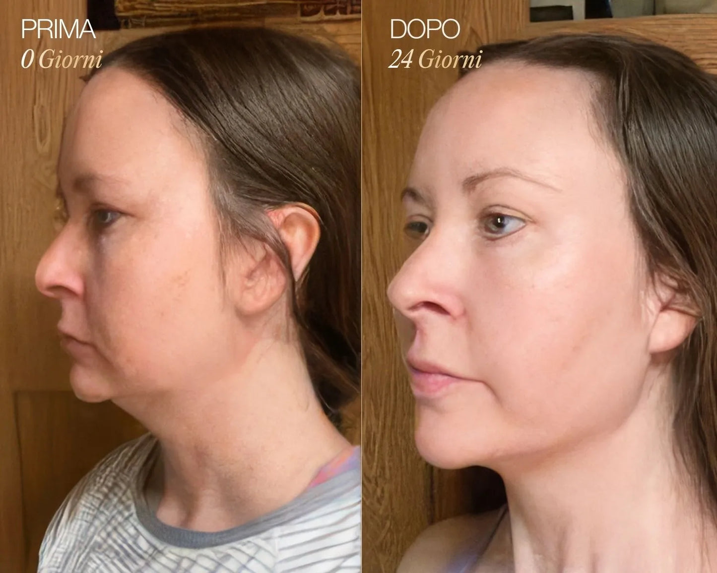 Velymra™ Lymphatic Face Brush – Gesicht entstauen, Kieferlinie definieren & Haut straffen