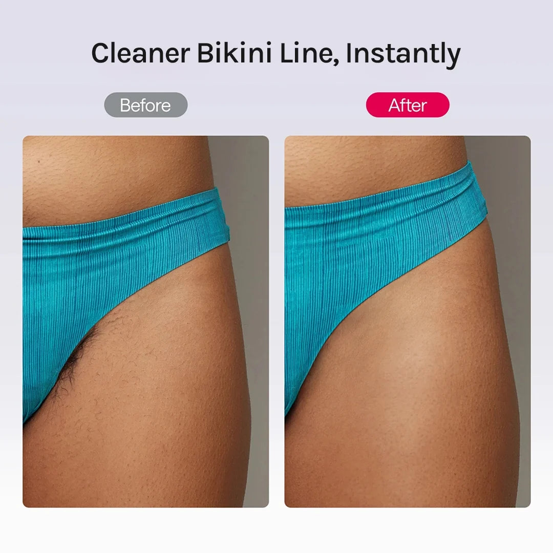 SilkTrim™ 2-in-1 Bikini- & Körperhaartrimmer – Für sanfte, gepflegte Haut