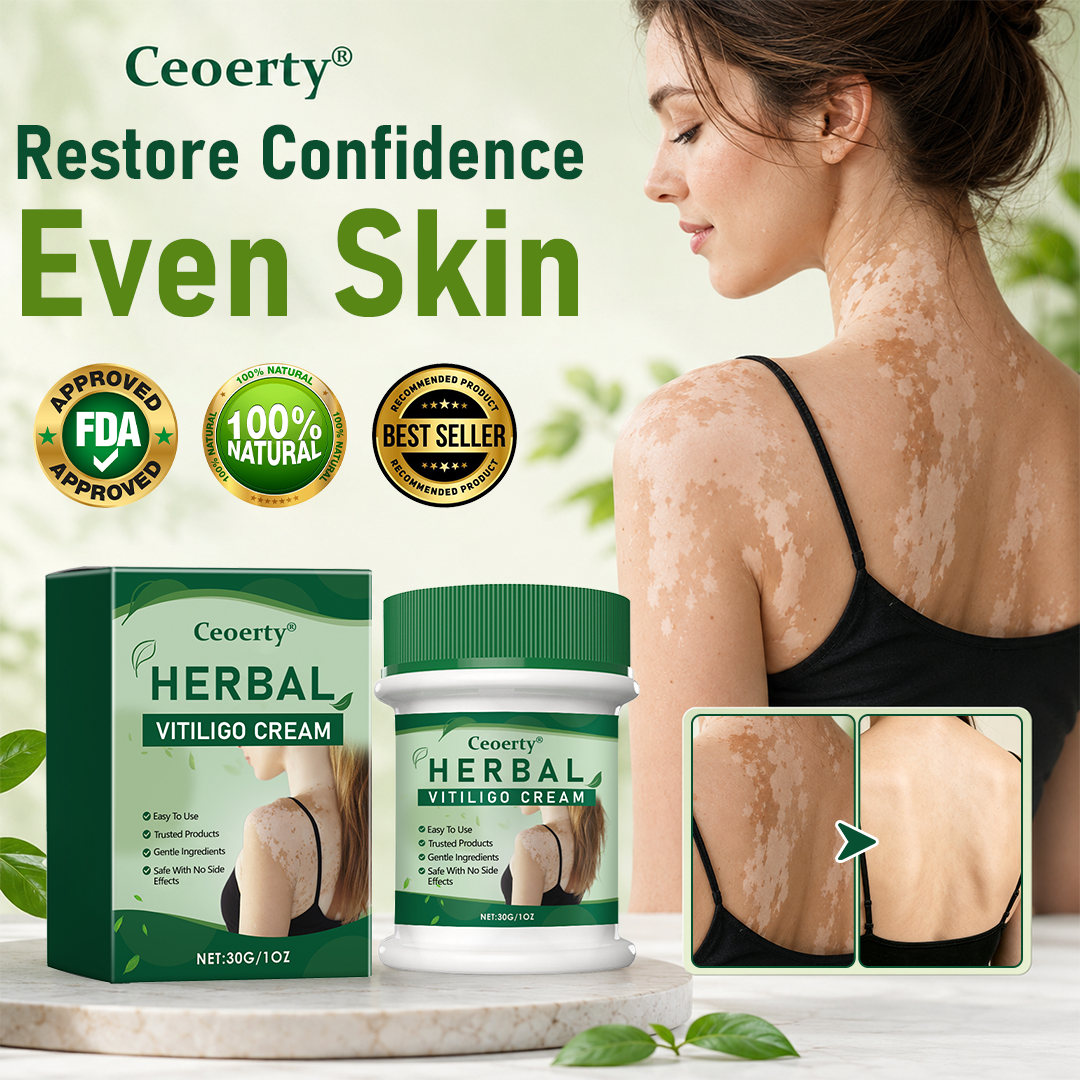 Vitarelle™ Herbal Vitiligo Creme – 7-Tage-Pflege für sichtbar gleichmäßigeren Hautton