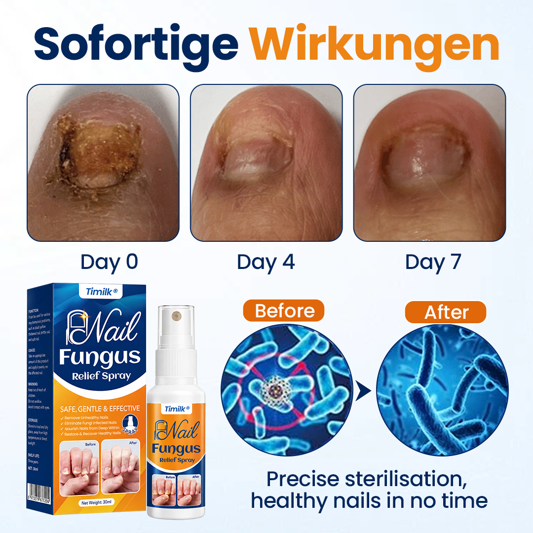 NailForte™ Nagelpilz-Spray – Schnelle Hilfe für gesunde & klare Nägel