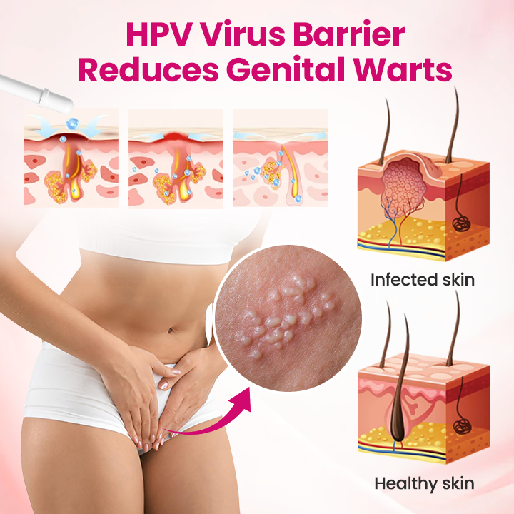 ViraCera™ IntiDefend Anti-HPV Interferon-Gel – Unterstützt HPV-Abwehr, Schleimhautheilung & Intimgesundheit
