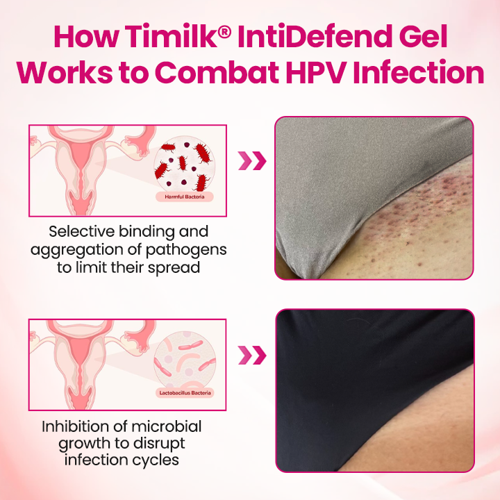 ViraCera™ IntiDefend Anti-HPV Interferon-Gel – Unterstützt HPV-Abwehr, Schleimhautheilung & Intimgesundheit