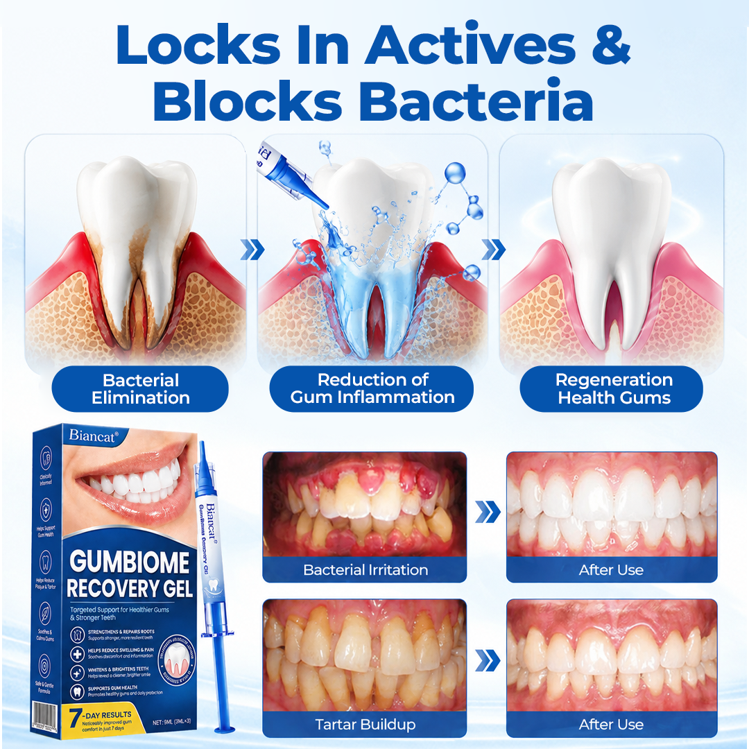 GumRevia™ GumBiome Recovery Gel – Gezielte Pflege für Zahnfleisch & Zahnfleischrückgang