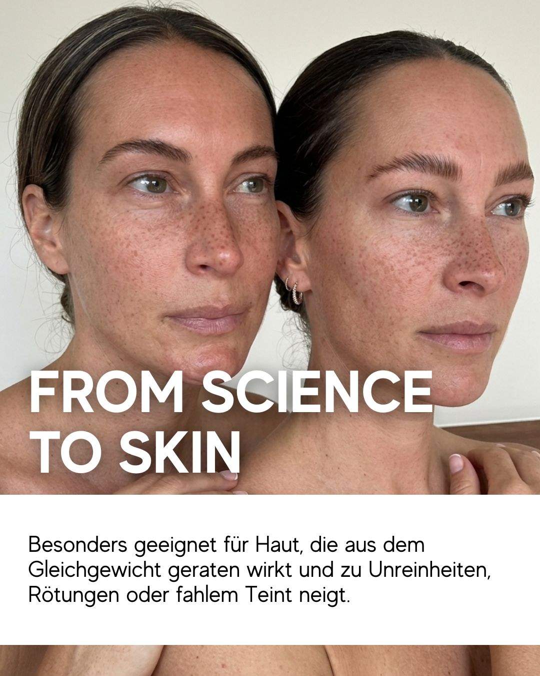 Coldplasma™ - Hautpflege-Booster
