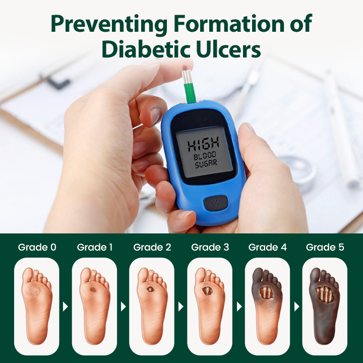 GlucoVera™ Regenerative Fußcreme für Diabetiker – Intensive Pflege bei trockenen & rissigen Füßen