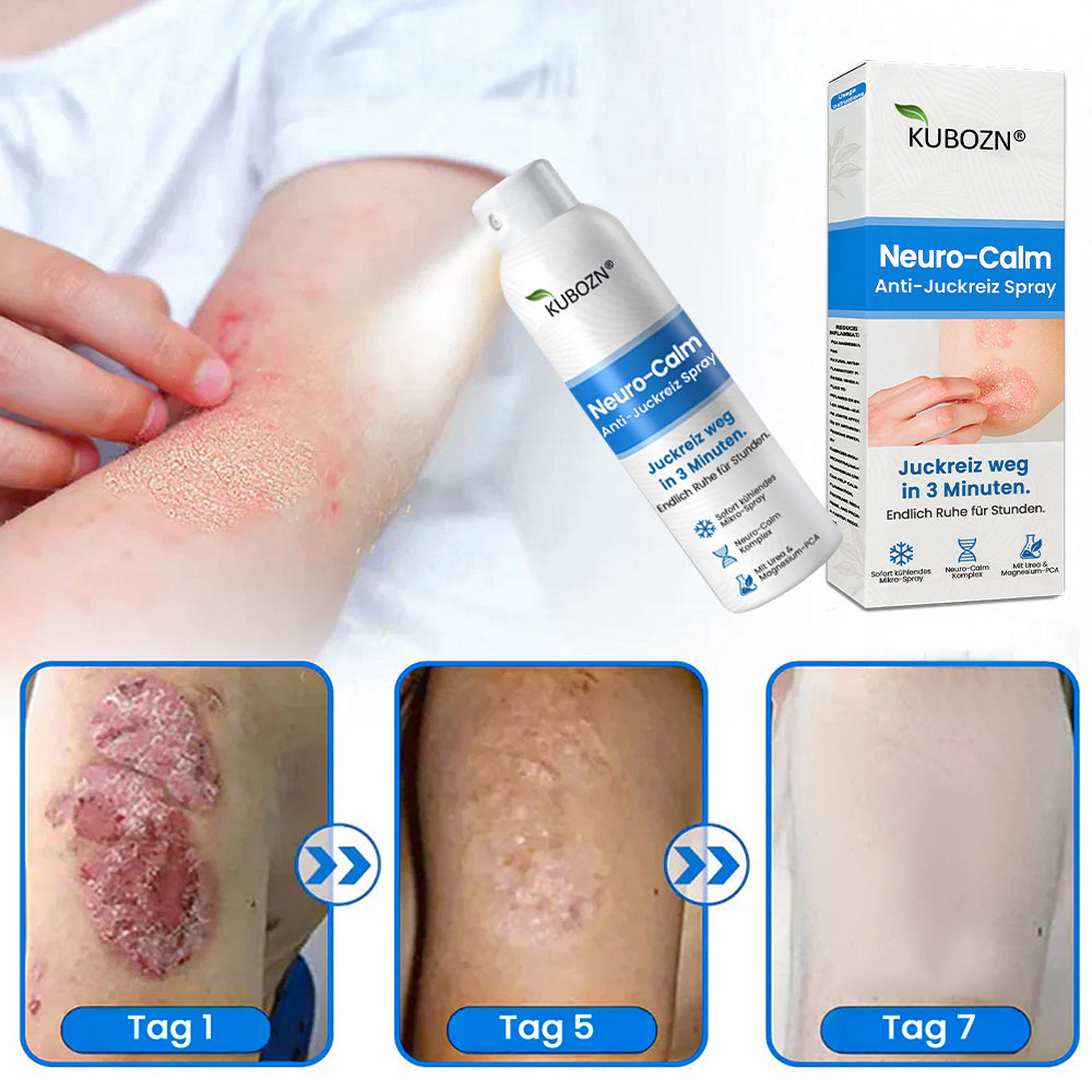 KUBOZN® | Magnesium Kräuter-Spray für Psoriasis-neigende Haut