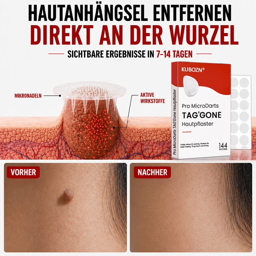 KUBOZN® Hautpflaster zur Skin-Tag-Entfernung  🅱︎