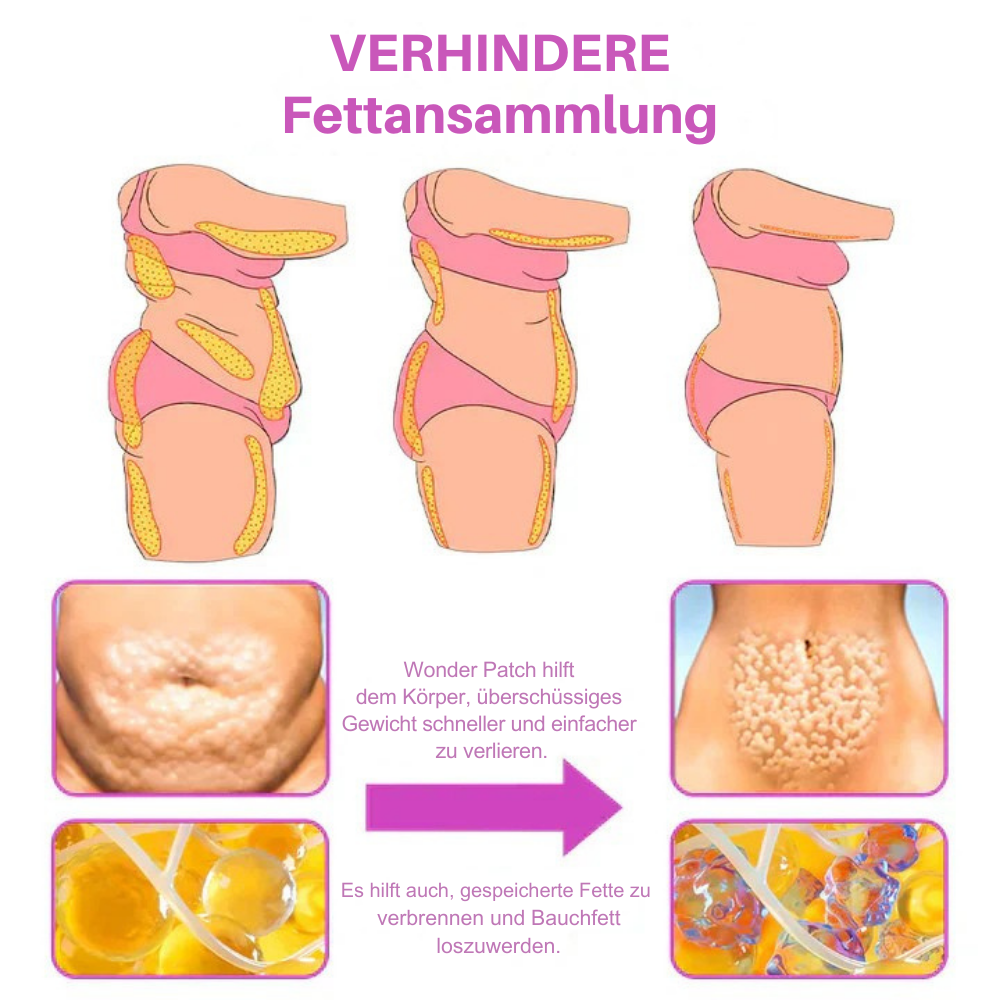 Schlankheits-Bauchpflaster | Pflanzliche Unterstützung für Bauchstraffung & Gewichtsmanagement | 10 Pflasters