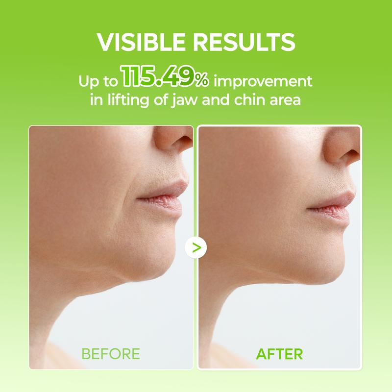 Velyra™ V-Lifting Mewing Mask – Strafft Kiefer & Kinn und reduziert Doppelkinn