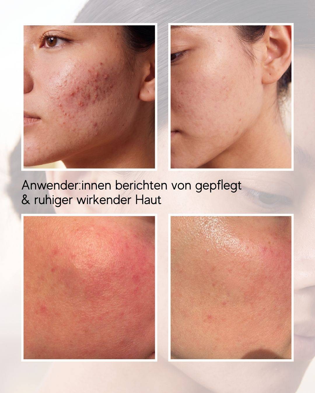 Coldplasma™ - Hautpflege-Booster
