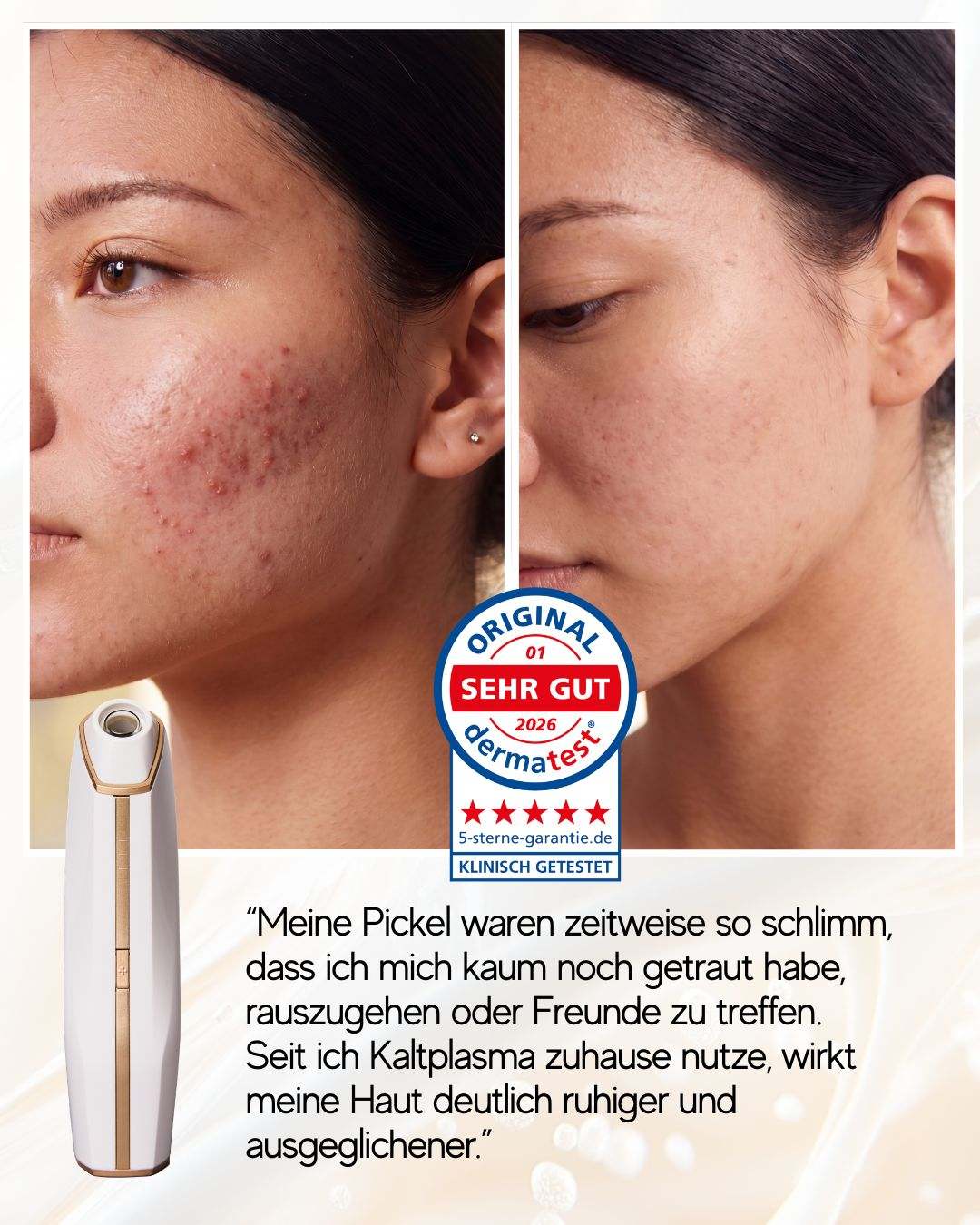 Coldplasma™ - Hautpflege-Booster