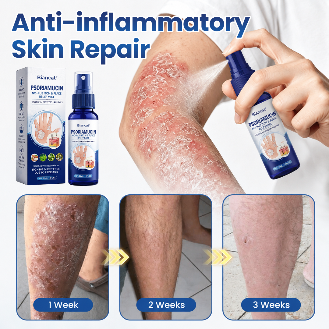PsoriaVelle™ No-Rub Psoriasis Spray – Gezielte Pflege bei Juckreiz & Schuppen