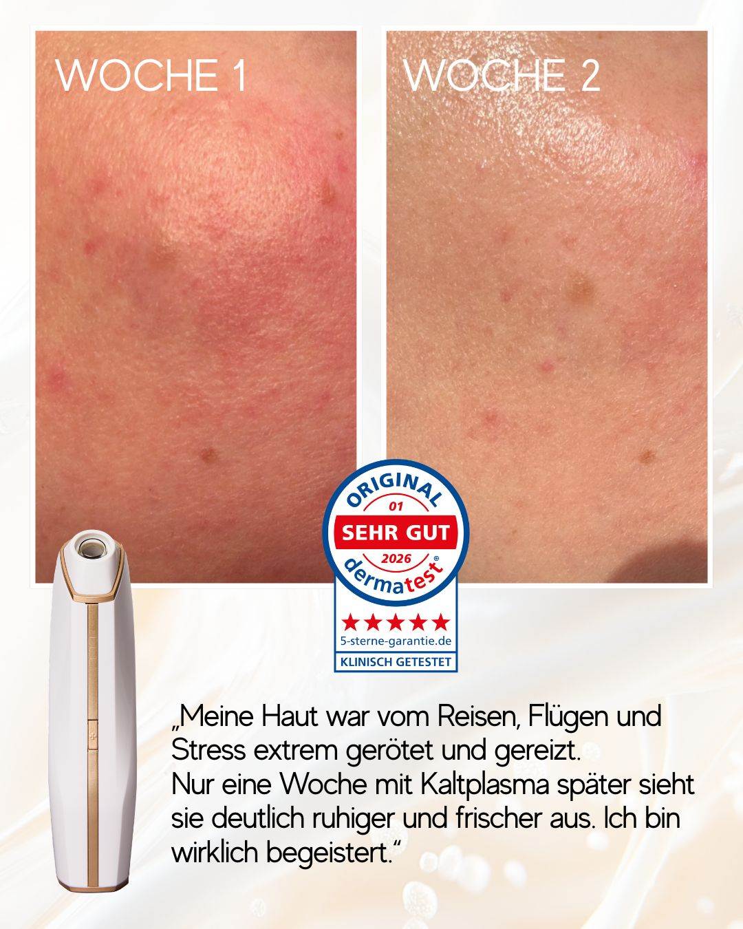 Coldplasma™ - Hautpflege-Booster