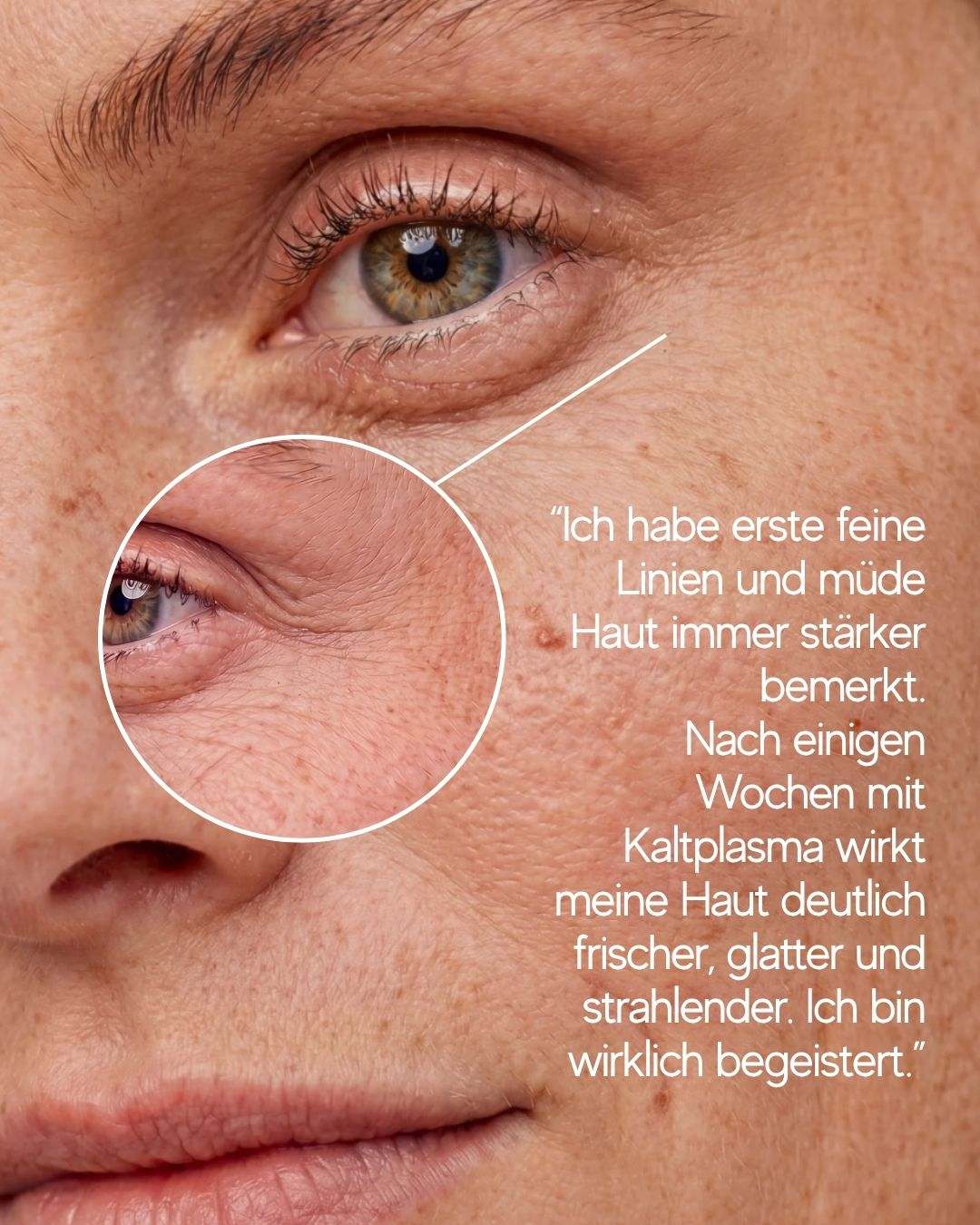 Coldplasma™ - Hautpflege-Booster
