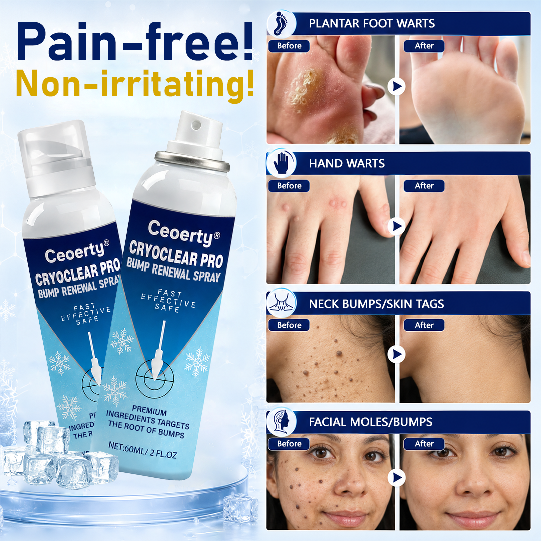 CryoLisse™ Bump-Erneuerungsspray – Erhabene Unebenheiten glätten, Rötungen beruhigen & raue Haut pflegen