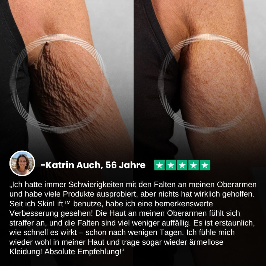 DermaLisse™ Kollagen-Lifting Körperöl – Für Glatter & Straffer Aussehende Haut