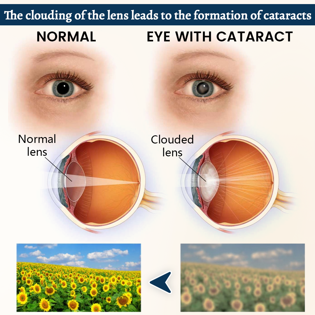 VisionLuma™ Potentes Augenpflaster – Für klare Sicht & entspannte, müde Augen