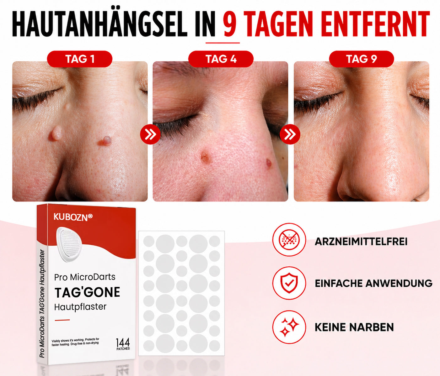 KUBOZN® Hautpflaster zur Skin-Tag-Entfernung  🅱︎
